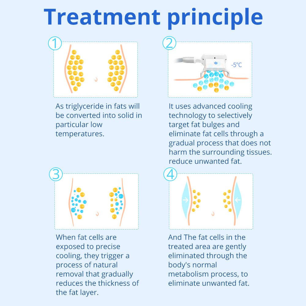 Shape Tactics - Cryolipoysis Cold Vacuum Fat Freeze Shaping Machine: Transform Your Body with Non-Invasive Fat Reduction