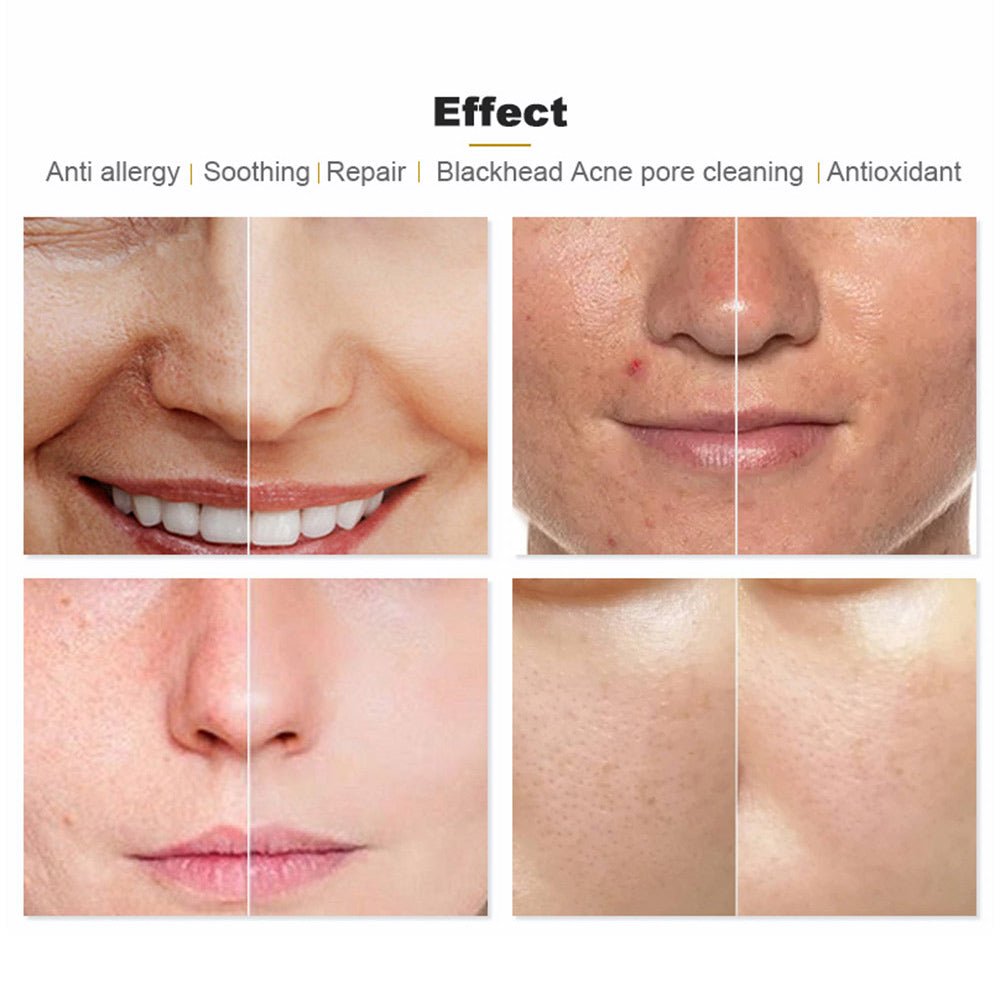 Hydroge Pro Skin Rejuvenation System - Transform Your Skin