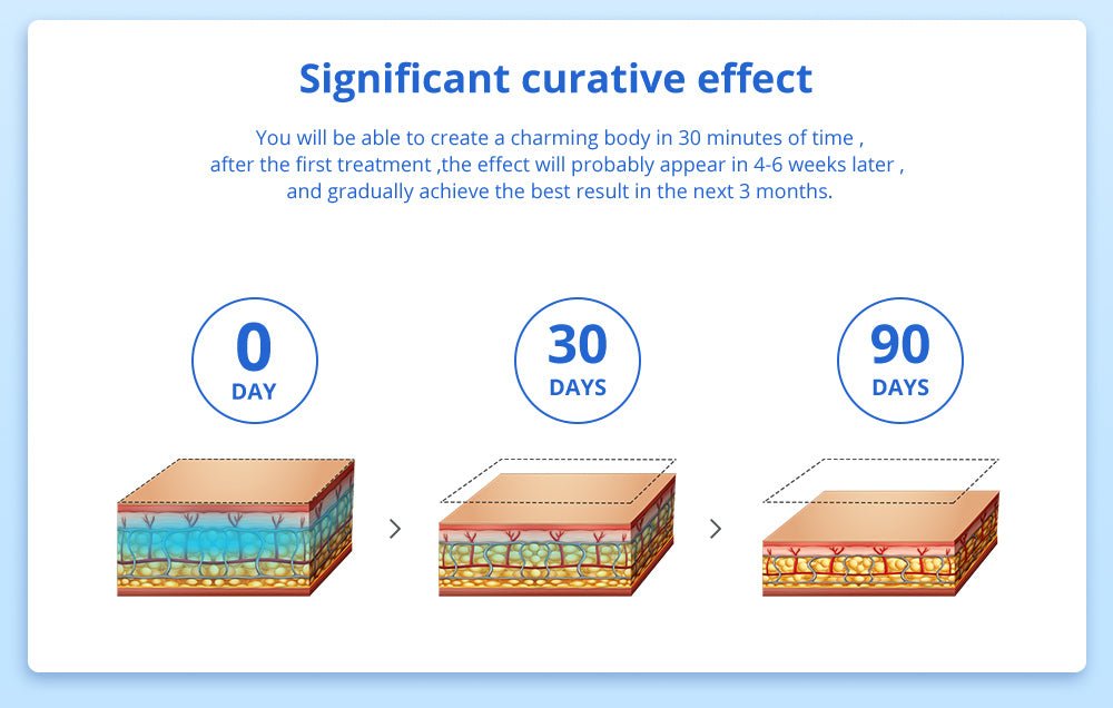 Shape Tactics - Advanced Fat Freezing Slimming Machine for Stand-Up Use