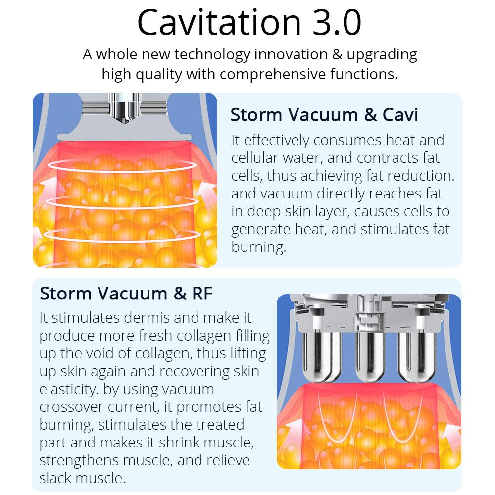 Shape Tactics CaVstorm 40K Cavitation 3.0 All-in-One Fat Reduction Machine
