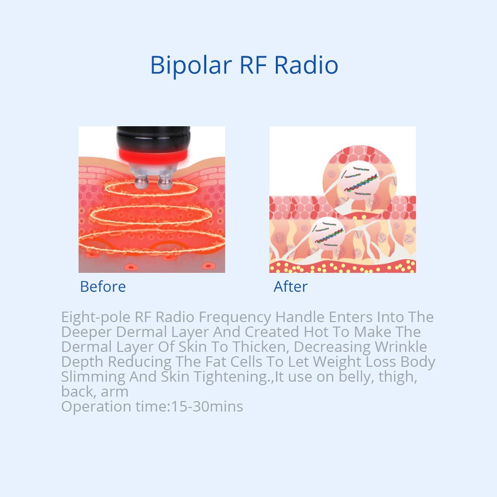 Advanced 5-in-1 Body Cryolipolysis 40K RF Lipo Laser - Shape Tactics