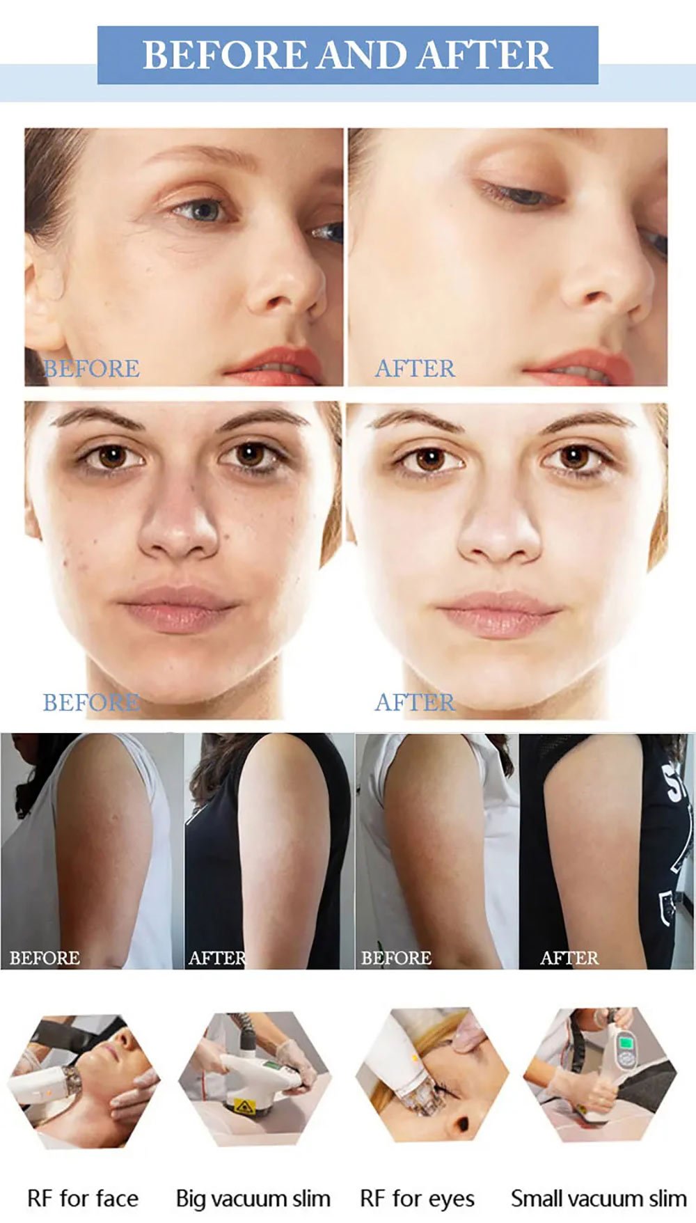 Advanced Body Sculpting Device with Negative Pressure and Inner Ball Roller Technology