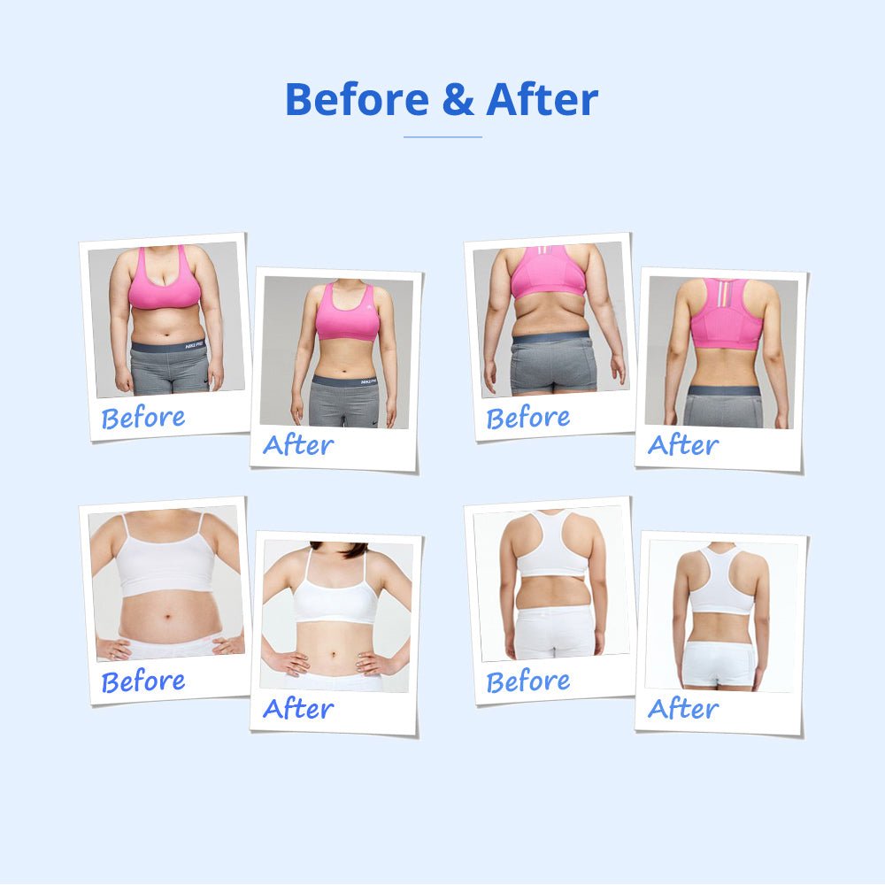 Shape Tactics - Revolutionary 160mw Lipo Laser Fat Freeze Machine with Cavitation
